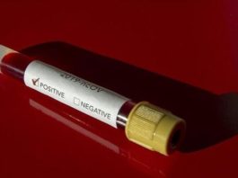 Corona Virüs Test Sonuçları