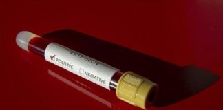 Corona Virüs Test Sonuçları