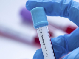 E-Nabız Covid 19 İdari İzin