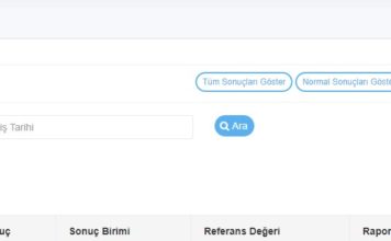 E-Nabız çıktı alma﻿