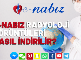 E-nabız radyoloji görüntüleri nasıl indirilir?