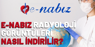 E-nabız radyoloji görüntüleri nasıl indirilir?