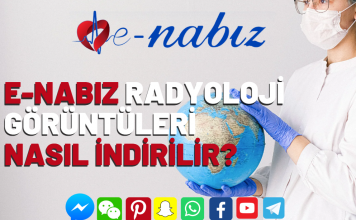 E-nabız radyoloji görüntüleri nasıl indirilir?