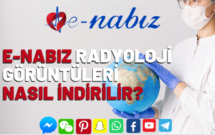 E-nabız radyoloji görüntüleri nasıl indirilir?